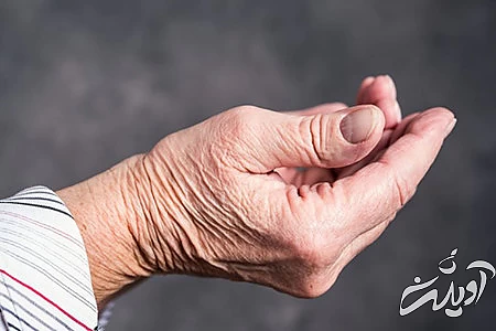 آرتریت روماتوئید, مشکلات ریه چه علائمی دارد, سلامت ریه